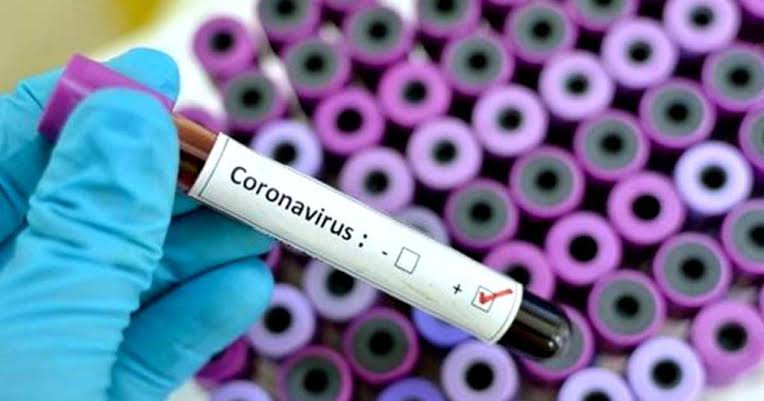 Anies Perpanjang Status Darurat Corona Ibukota Hingga 19 April