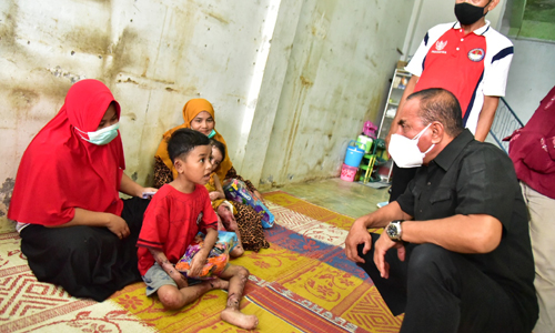 Jenguk Dua Anak Penderita Penyakit Kulit, Edy Rahmayadi Rujuk Haikal dan Zakira ke RS Haji Medan
